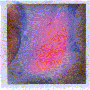 Acid Gift Effect